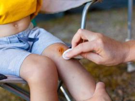 Переваги та правила використання мазі від забоїв