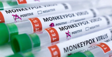В Україні зареєстрований перший випадок віспи мавп: детально про хворобу роз'яснили у МОЗ
