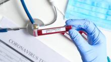 COVID-19: що робити у разі підозри на захворювання і чи потрібна самоізоляція?