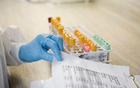 Чи може інфікований гепатитом А працівник продовжувати працювати?