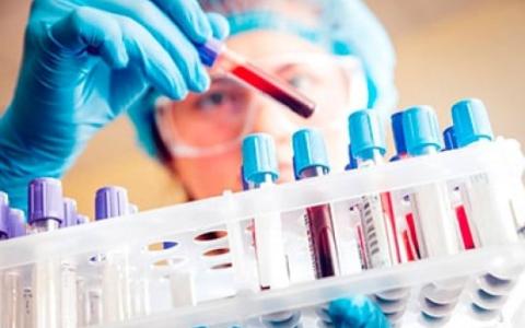 Українці за кордоном можуть здати ДНК для пошуку рідних, зниклих безвісти