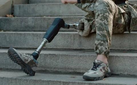 Протезування в Україні —  безоплатне: куди звертатись та що потрібно для отримання протезу?